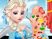 Elsa Foot Doctor Game